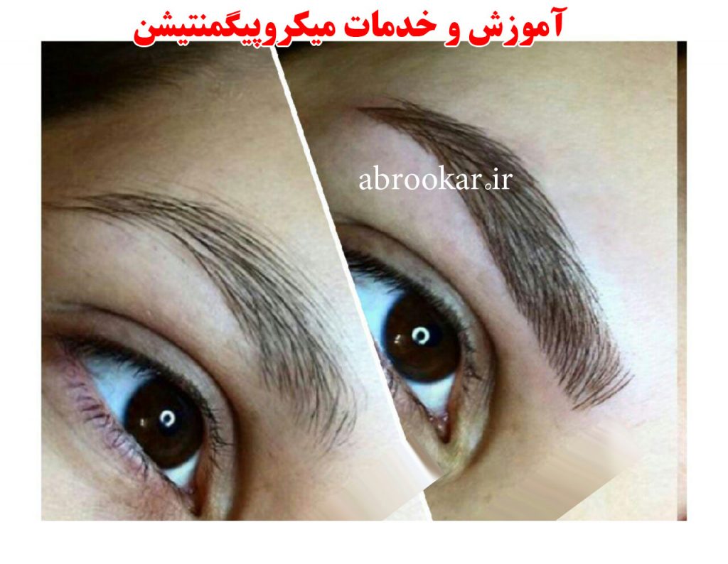 هزینه آموزش میکروپیگمنتیشن